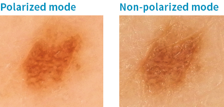 Polarized, non-polarized mode switching with one touch